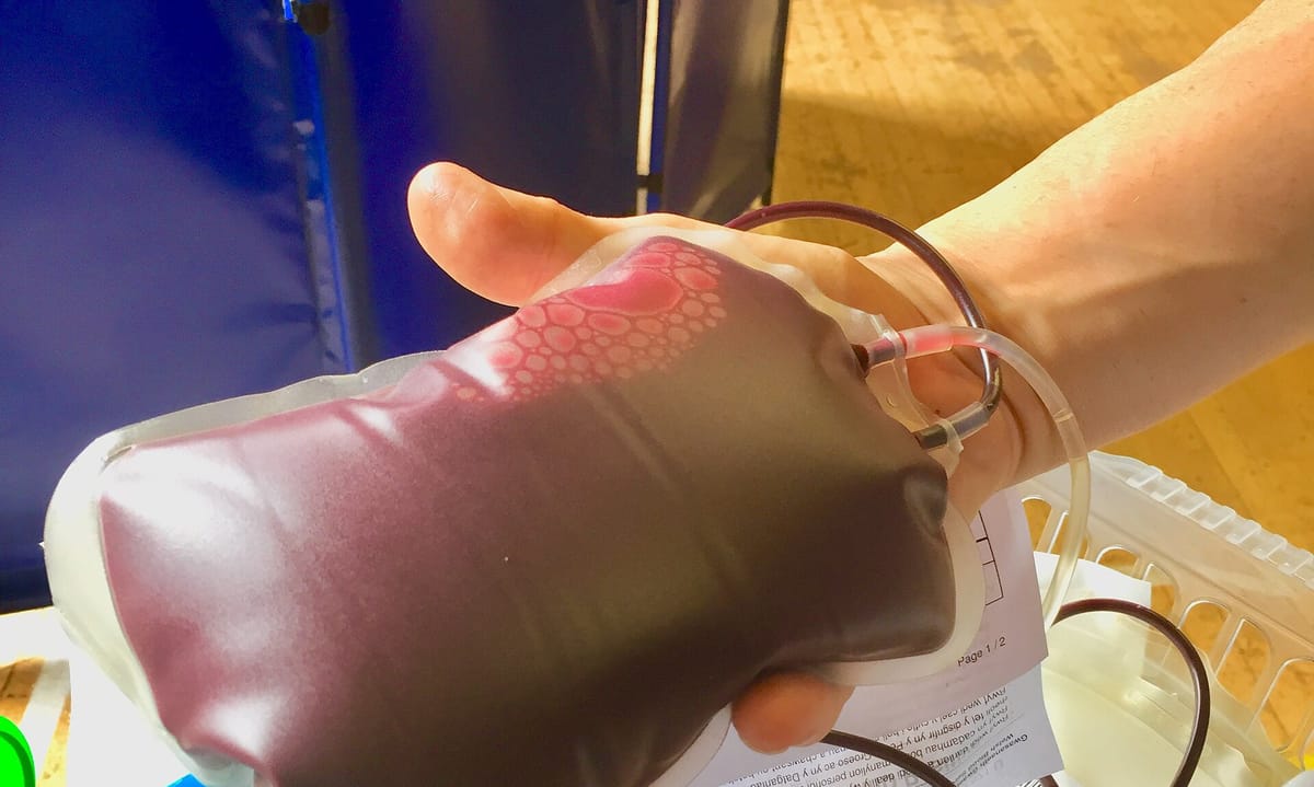 Algarve Hospitals Are Holding Thinner Blood Stocks Than a Normal August, and the Region's Health Chief Stops Short of the Word Crisis