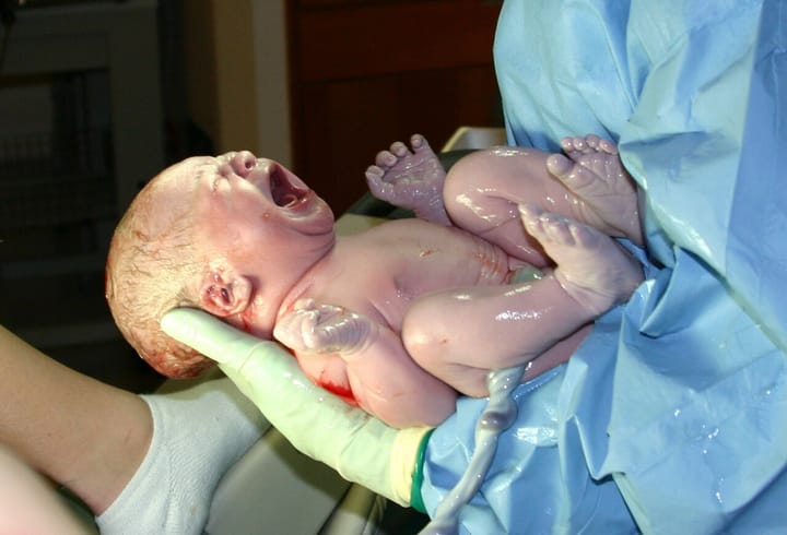 Scheduled Caesareans Quadruple in a Year as Portuguese Births Climb 3.6%